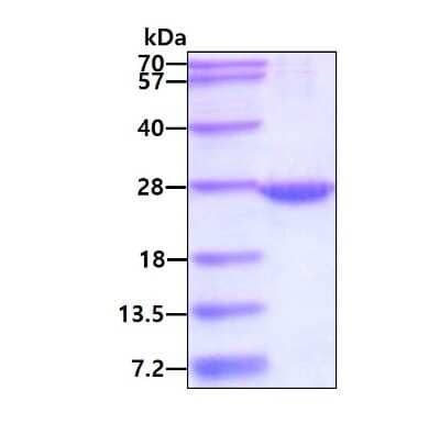 SDS-Page: Recombinant Human RAB22A His Protein [NBP1-72452] - 3ug by SDS-PAGE under reducing condition and visualized by coomassie blue stain